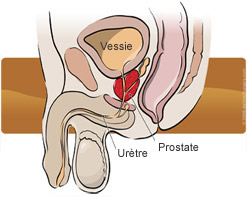 Prostate